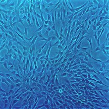 Human Chondrocytes (HC) Human Chondrocytes (HC)