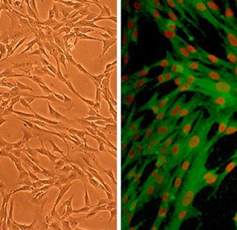 Human Astrocytes (HA) Human Astrocytes (HA)