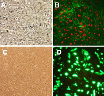 human-lung-microvascular human lung microvascular