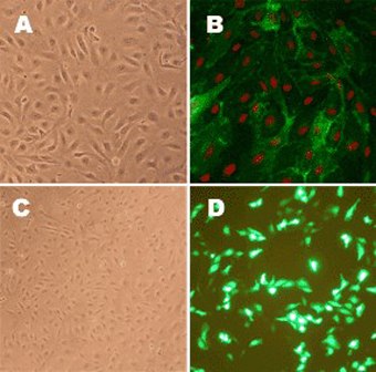 Human pulmonary artery endothelial cells Human Pulmonary Artery Endothelial Cells (HPAEC)