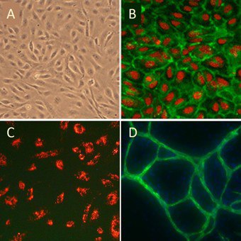 Human Umbilical Vein Endothelial Cells (HUVEC) 200-05n-cells