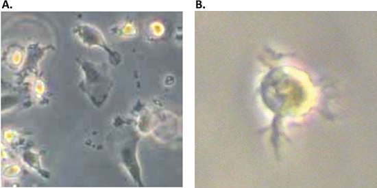 morphology-immature-mature-monocyte Morphology of immature and mature monocyte