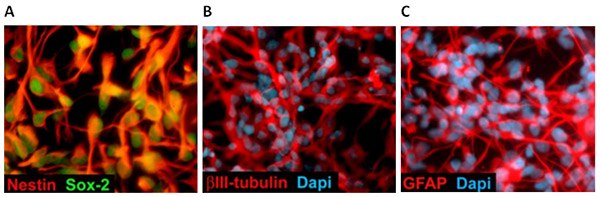 Differentiation of Neural Stem Cells. Differentiation of Neural Stem Cells.