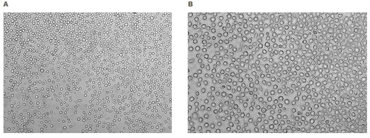 Morphology of human CD34+ hematopoietic progenitor cells. Morphology of human CD34+ hematopoietic progenitor cells 10X