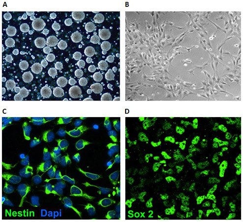 Neural stem cell culture characteristics. Neural stem cell culture characteristics.