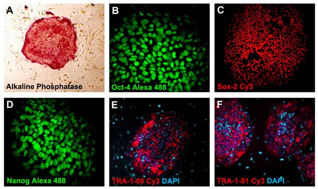 Pluripotent iPS cells express pluripotency markers. Pluripotent iPS cells express pluripotency markers.