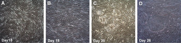 LIGHT   DIAGNOSTICS Time course of human iPSC colonies generation using Human Simplicon RNA Reprogramming Kit