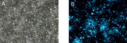 Transfection efficiency Transfection efficiency