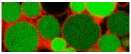 L-form of Listeria monocytogenes L-form of Listeria monocytogenes