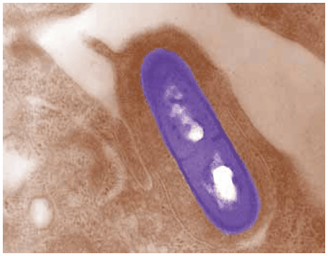 Electron micrograph of a Listeria monocytogenes bacterium in tissue Electron micrograph of a Listeria monocytogenes bacterium in tissue