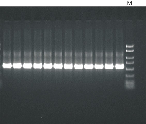 PCR amplification  PCR amplification