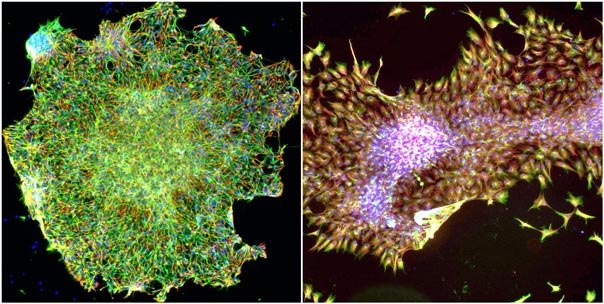 hESC Transduction Protocol Feeder free hESC's were transduced using the above protocol, and then imaged by fluorescence microscopy. Nuclei were stained (blue) to indicated cell position and viability, and beta-III-tubulin (green) was detected via immunofluorescence (IF) microscopy. In addition, nestin levels (red) were also detected by IF microscopy. Left: Cells transduced with shRNA targeting RhoA resulting in differentiation into neural pre-cursors. Right: Cells transduced with non-target viral control resulting in normal stem cell colonies. Membranous staining by beta-III-tubulin and spindle morphology indicate neuronal differentiation in the RhoA shRNA treated cells. Finally, the non-target treated cells maintained strong cytoplasmic nestin staining.