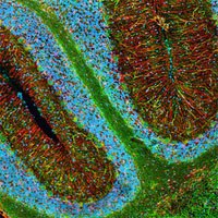 fluorescent microscopy fluorescent microscopy