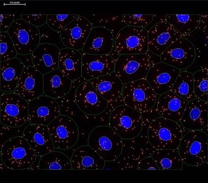 Image analysis using imaging software  Image analysis using imaging software