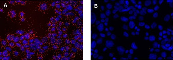 Detection of EGFR in cytospin preparations of A431 cells using Duolink® PLA Detection of EGFR in cytospin preparations of A431 cells using Duolink® PLA