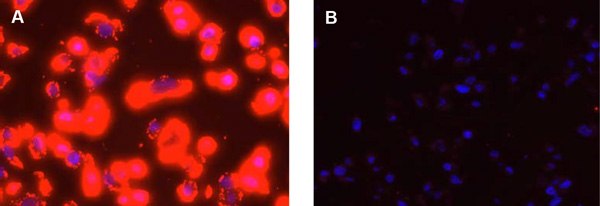 Detection of Her2 in FFPE preparations of SKBR-3 high expression cells using Duolink® PLA Detection of Her2 in FFPE preparations of SKBR-3 high expression cells using Duolink® PLA