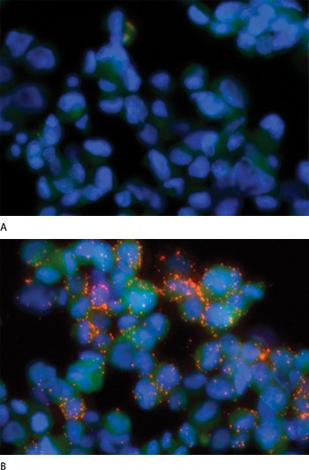 Detection of phosphorylated EGF receptors using Duolink™ In Situ Probemaker Detection of phosphorylated EGF receptors using Duolink™ In Situ Probemaker