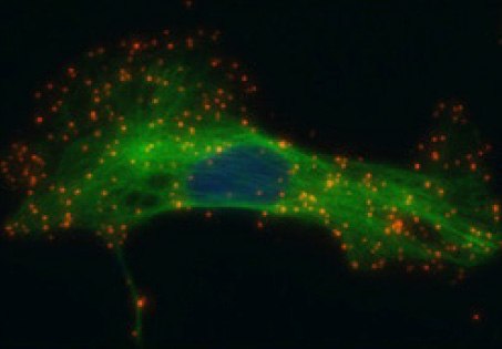 Single recognition of HER2 in SK-BR-3 cells.  Single recognition of HER2 in SK-BR-3 cells.