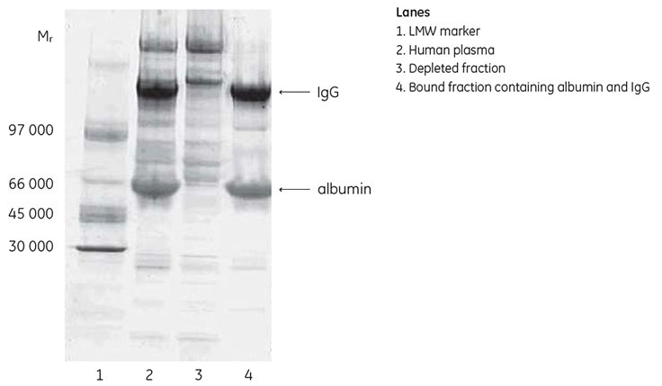 Deep Purple stained SDS-PAGE analysis (nonreducing conditions) of fractions from the depletion of human plasma using HiTrap® Albumin & IgG Depletion. Deep Purple stained SDS-PAGE analysis (nonreducing conditions) of fractions from the depletion of human plasma using HiTrap Albumin & IgG Depletion