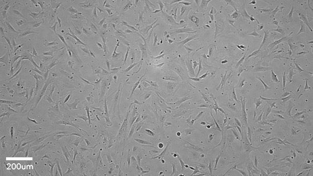 Stellate cells Stellate cells imaged after 4 days of incubation. Stellate cells were plated at a density of 4000 cells/cm2 on collagen-coated plate