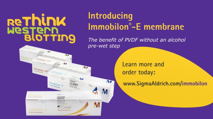 Immobilon<sup>®</sup>-E PVDF Membrane for Western Blotting Immobilon<sup>®</sup>-E PVDF Membrane for Western Blotting