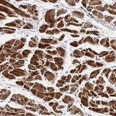 Anti-CDK20 antibody produced in rabbit Prestige Antibodies&#174; Powered by Atlas Antibodies, affinity isolated antibody, buffered aqueous glycerol solution, ab3