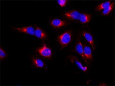 Anti-TGN46 antibody produced in rabbit ~1&#160;mg/mL, affinity isolated antibody, buffered aqueous solution