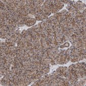 Anti-SCRIB antibody produced in rabbit Prestige Antibodies&#174; Powered by Atlas Antibodies, affinity isolated antibody, buffered aqueous glycerol solution