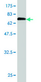 Monoclonal Anti-ENO1 antibody produced in mouse clone 8G8, purified immunoglobulin, buffered aqueous solution