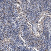 Anti-C5 antibody produced in rabbit Prestige Antibodies&#174; Powered by Atlas Antibodies, affinity isolated antibody, buffered aqueous glycerol solution