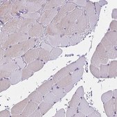 Anti-SLC12A3 antibody produced in rabbit Prestige Antibodies&#174; Powered by Atlas Antibodies, affinity isolated antibody, buffered aqueous glycerol solution
