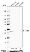 Anti-CALB2 antibody produced in rabbit Prestige Antibodies&#174; Powered by Atlas Antibodies, affinity isolated antibody, buffered aqueous glycerol solution