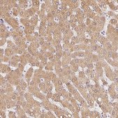 Anti-ACVR1B antibody produced in rabbit Prestige Antibodies&#174; Powered by Atlas Antibodies, affinity isolated antibody, buffered aqueous glycerol solution