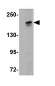 Anti-PALB2 Antibody from rabbit, purified by affinity chromatography