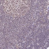 Anti-PTPN2 antibody produced in rabbit Prestige Antibodies&#174; Powered by Atlas Antibodies, affinity isolated antibody, buffered aqueous glycerol solution