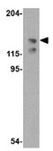 Anti-ADAP Antibody from rabbit, purified by affinity chromatography