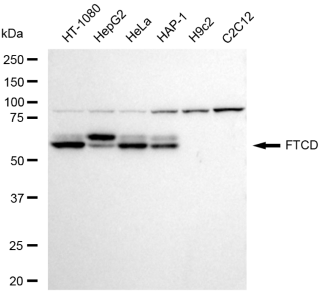 Anti FTCD Antibody, clone 23GB5765, Rabbit Monoclonal clone 23GB5765, recombinant rabbit monoclonal, expressed in HEK293 cells