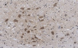 Anti-Choline Acetyltransferase (ChAT) Antibody, clone 2K16, ZooMAb® Rabbit Monoclonal recombinant, expressed in HEK 293 cells