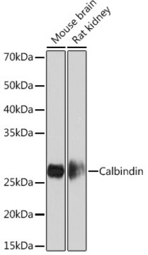 Anti-Calbindin Antibody, clone 1K2K2, Rabbit Monoclonal