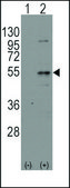 Anti-ARHGEF9 (center) antibody produced in rabbit affinity isolated antibody, buffered aqueous solution