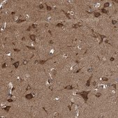 Anti-KCNJ2 antibody produced in rabbit Prestige Antibodies&#174; Powered by Atlas Antibodies, affinity isolated antibody, buffered aqueous glycerol solution