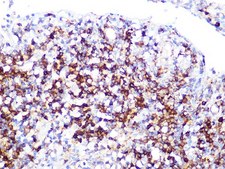 Anti-LDHB antibody produced in rabbit