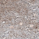 Monoclonal Anti-NR5A1 antibody produced in mouse Prestige Antibodies® Powered by Atlas Antibodies, clone CL9101, purified immunoglobulin, buffered aqueous glycerol solution