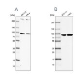 Anti-RPAP3 antibody produced in rabbit Prestige Antibodies&#174; Powered by Atlas Antibodies, affinity isolated antibody, buffered aqueous glycerol solution