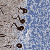 Anti-ITPR1 antibody produced in rabbit Prestige Antibodies&#174; Powered by Atlas Antibodies, affinity isolated antibody, buffered aqueous glycerol solution