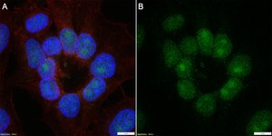 Anti-Phospho-IκBα-Ser32/36 Antibody, clone 1I11 ZooMAb&#174; Rabbit Monoclonal recombinant, expressed in HEK 293 cells