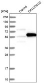 Anti-CALCOCO2 antibody produced in rabbit Prestige Antibodies&#174; Powered by Atlas Antibodies, affinity isolated antibody, buffered aqueous glycerol solution, Ab2