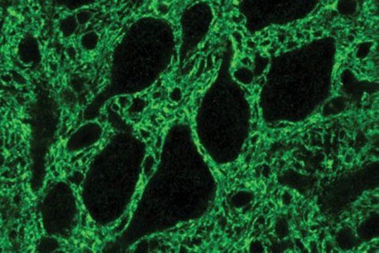 Anti-Glutamate Transporter Antibody, Glial serum, Chemicon&#174;
