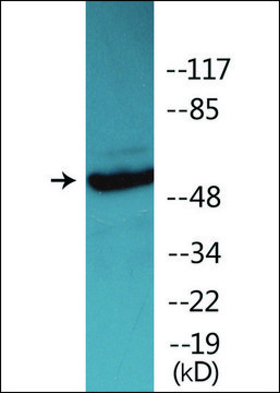 Anti-phospho-Vimentin (pSer83) antibody produced in rabbit affinity isolated antibody