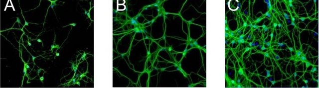 Anti-MAP2 (2a+2b) antibody, Mouse monoclonal clone AP-20, ascites fluid